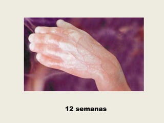 12 semanas
 