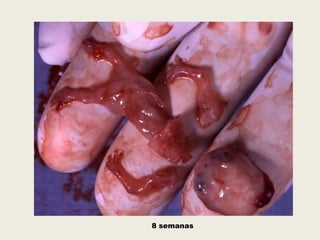 8 semanas
 