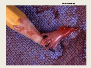 10 semanas
 