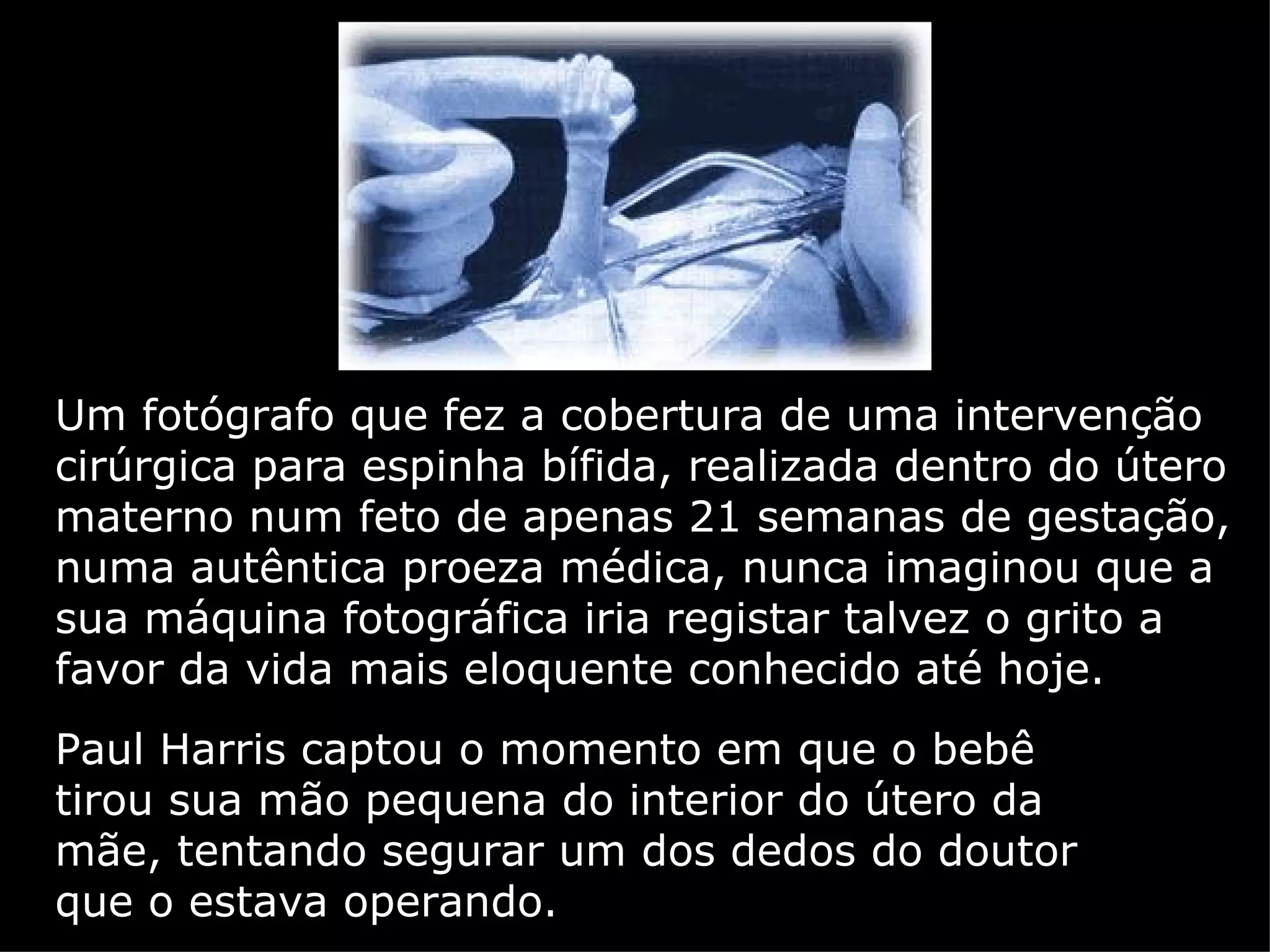 Um fotógrafo que fez a cobertura de uma intervenção cirúrgica para espinha bífida, realizada dentro do útero materno num feto de apenas 21 semanas de gestação, numa autêntica proeza médica, nunca imaginou que a sua máquina fotográfica iria registar talvez o grito a favor da vida mais eloquente conhecido até hoje. Paul Harris captou o momento em que o bebê tirou sua mão pequena do interior do útero da mãe, tentando segurar um dos dedos do doutor que o estava operando. 