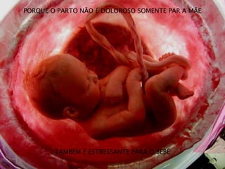 PORQUE O PARTO NÃO É DOLOROSO SOMENTE PAR A MÃE
TAMBÉM É ESTRESSANTE PARA O BEBÊ
 