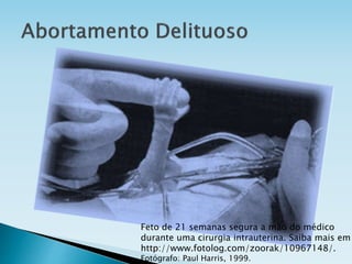 Feto de 21 semanas segura a mão do médico
durante uma cirurgia intrauterina. Saiba mais em
http://www.fotolog.com/zoorak/10967148/.
Fotógrafo: Paul Harris, 1999.
 