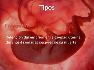 Retención del embrión en la cavidad uterina,
durante 4 semanas después de su muerte.
 
