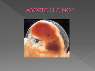 Aborto diapositivas