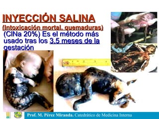 INYECCIÓN SALINA (Intoxicación mortal, quemaduras) (ClNa 20%)   Es el método más  usado tras los  3,5 meses de la gestación 
