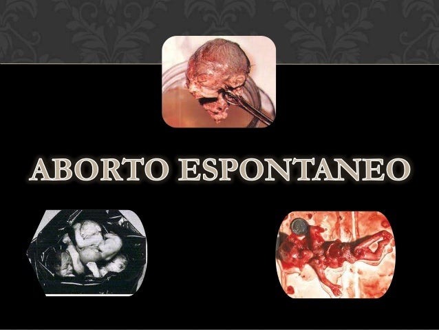 aborto-espontaneo-1-638 Perdida