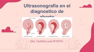 Dra. Cynthia Luna R1GYO.
Ultrasonografía en el
diagnostico de
aborto
 