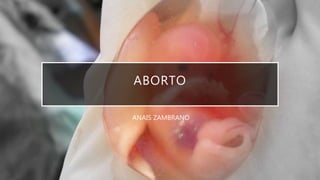 ABORTO
ANAIS ZAMBRANO
 