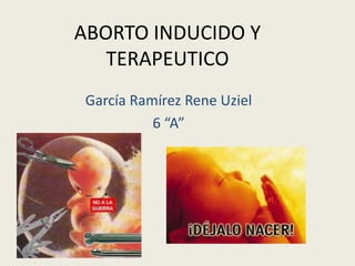 ABORTO INDUCIDO Y
TERAPEUTICO
García Ramírez Rene Uziel
6 “A”
 