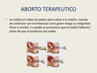 ABORTO TERAPEUTICO
• se realiza en todos los países para salvar a la madre, cuando
de continuar con el embarazo corre grave riesgo su integridad
física o mental, o cuando se pronostica que la madre fallecerá
antes de que el producto sea viable.
 