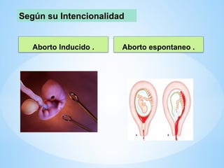 Aborto Inducido . Aborto espontaneo .
Según su Intencionalidad
 