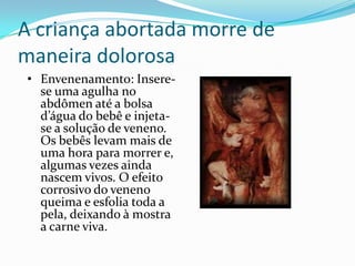 A criança abortada morre de maneira dolorosaEnvenenamento: Insere-se uma agulha no abdômen até a bolsa d’água do bebê e injeta-se a solução de veneno. Os bebês levam mais de uma hora para morrer e, algumas vezes ainda nascem vivos. O efeito corrosivo do veneno queima e esfolia toda a pela, deixando à mostra a carne viva. 