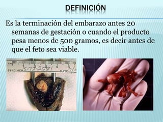 Definición Es la terminación del embarazo antes 20 semanas de gestación o cuando el producto pesa menos de 500 gramos, es decir antes de que el feto sea viable.