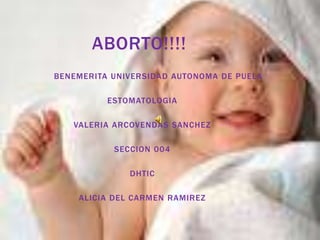 ABORTO!!!!
BENEMERITA UNIVERSIDAD AUTONOMA DE PUELA

          ESTOMATOLOGIA

   VALERIA ARCOVENDAS SANCHEZ

           SECCION 004

              DHTIC

    ALICIA DEL CARMEN RAMIREZ
 