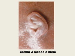 orelha 3 meses e meio
 