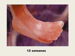 12 semanas
 
