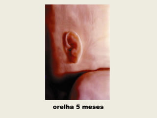 orelha 5 meses
 
