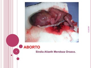 ABORTO
    ABORTO
1       Sindia Alizeth Mendoza Orozco.
 