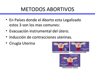 METODOS ABORTIVOS En Países donde el Aborto esta Legalizado estos 3 son los mas comunes: Evacuación instrumental del útero. Inducción de contracciones uterinas. Cirugía Uterina 