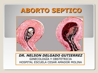 ABORTO SEPTICOABORTO SEPTICO
DR. NELSON DELGADO GUTIERREZ
GINECOLOGÍA Y OBSTETRICIA
HOSPITAL ESCUELA CESAR AMADOR MOLINA
 