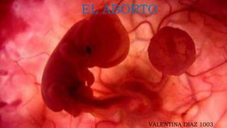 EL ABORTO
VALENTINA DIAZ 1003
 