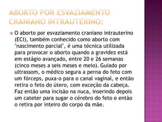    O aborto por esvaziamento craniano intrauterino
    (ECI), também conhecido como aborto com
    "nascimento parcial", é uma técnica utilizada
    para provocar o aborto quando a gravidez está
    em estágio avançado, entre 20 e 26 semanas
    (cinco meses a seis meses e meio). Guiado por
    ultrassom, o médico segura a perna do feto com
    um fórceps, puxa-o para o canal vaginal, e então
    retira o feto do útero, com exceção da cabeça.
    Faz então uma incisão na nuca, inserindo depois
    um cateter para sugar o cérebro do feto e então
    o retira por inteiro do corpo da mãe.
 