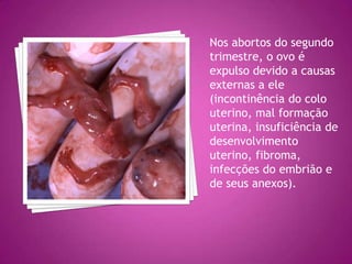 Nos abortos do segundo
trimestre, o ovo é
expulso devido a causas
externas a ele
(incontinência do colo
uterino, mal formação
uterina, insuficiência de
desenvolvimento
uterino, fibroma,
infecções do embrião e
de seus anexos).
 