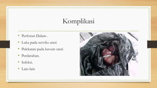 Komplikasi
• Perforasi Dalam .
• Luka pada serviks uteri
• Pelekatan pada kavum uteri
• Perdarahan.
• Infeksi.
• Lain-lain
 