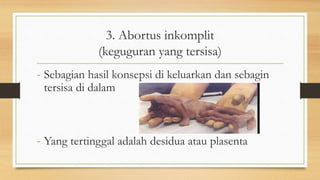 3. Abortus inkomplit
(keguguran yang tersisa)
- Sebagian hasil konsepsi di keluarkan dan sebagin
tersisa di dalam
- Yang tertinggal adalah desidua atau plasenta
 