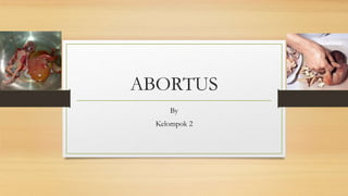 ABORTUS
By
Kelompok 2
 