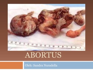 ABORTUS
Oleh: Sandra Nuradella
 