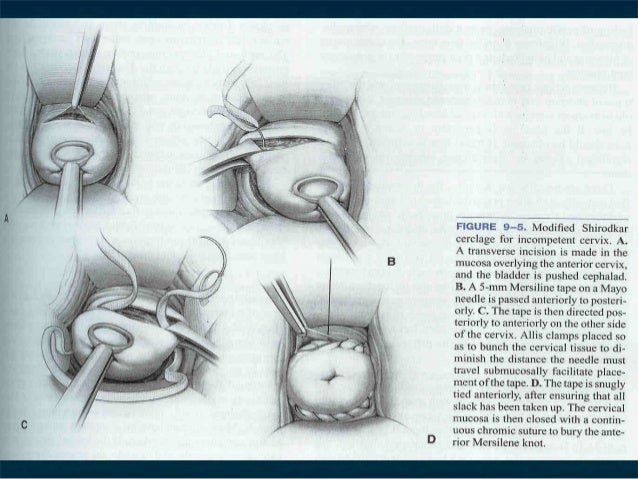 Dirty uncircumcised penis