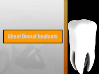 About Dental Implants
 