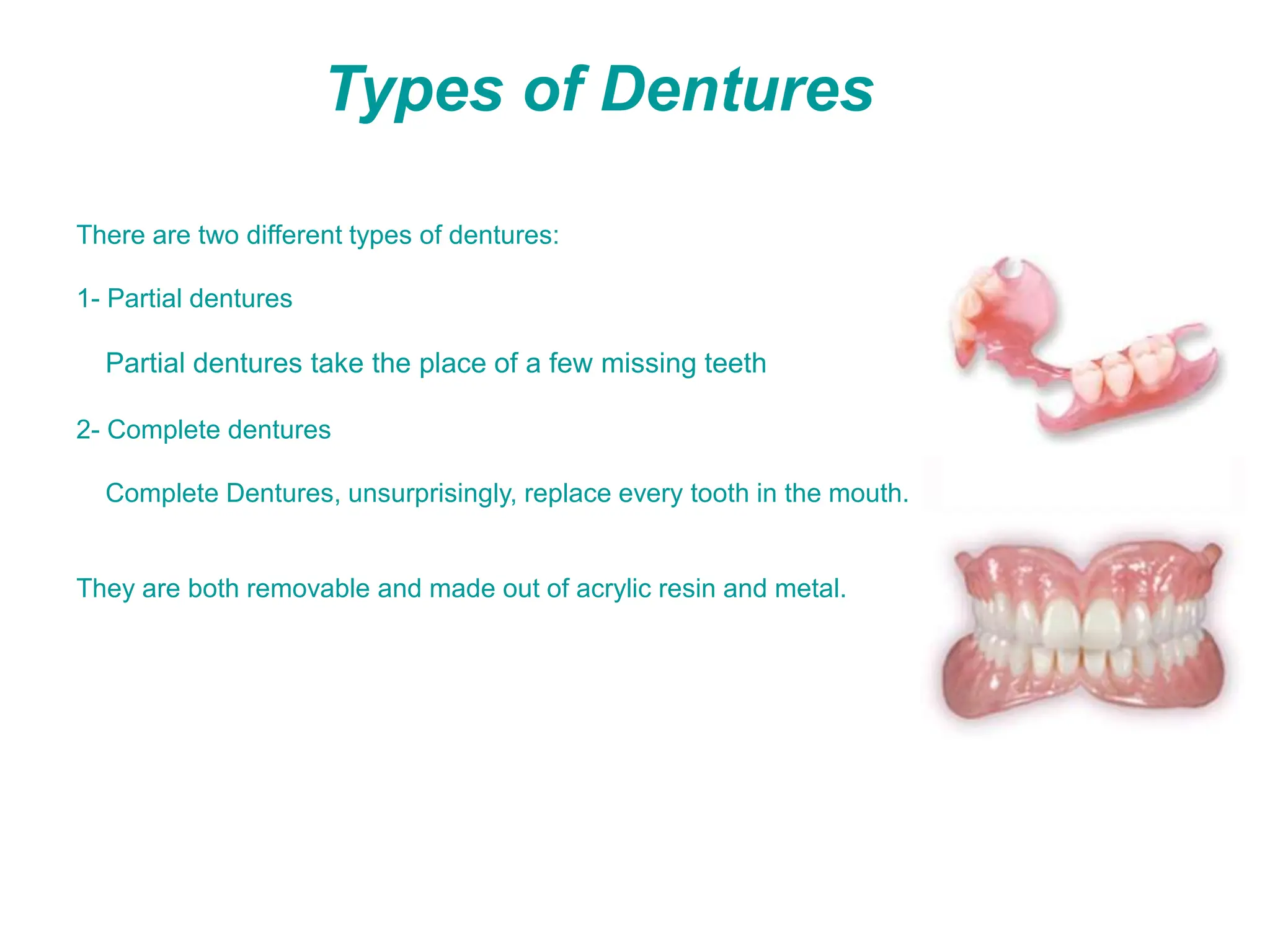 Types of Dentures
There are two different types of dentures:
1- Partial dentures
Partial dentures take the place of a few missing teeth
2- Complete dentures
Complete Dentures, unsurprisingly, replace every tooth in the mouth.
They are both removable and made out of acrylic resin and metal.
 