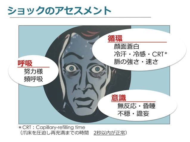 ショックについて | PDF | Lung and Respiratory Health | Diseases and Conditions
