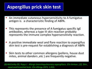 Allergic Broncho Pulmonary Aspergillosis (ABPA) by Dr.Tinku Joseph | PPTX