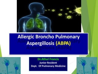 Allergic Broncho Pulmonary
Aspergillosis (ABPA)
Dr.Athul Francis
Junior Resident
Dept. Of Pulmonary Medicine
 