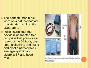 The subject wore a 24-hour ambulatory blood pressure monitor on