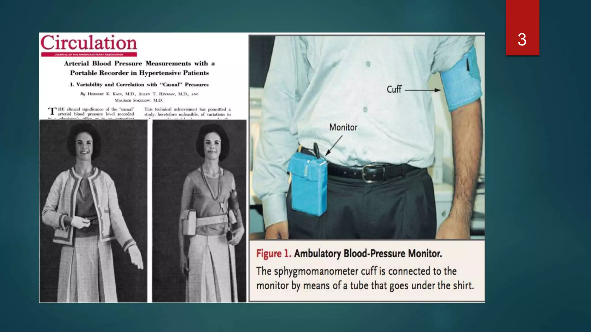 ambulatory blood pressure monitoring | PPTX