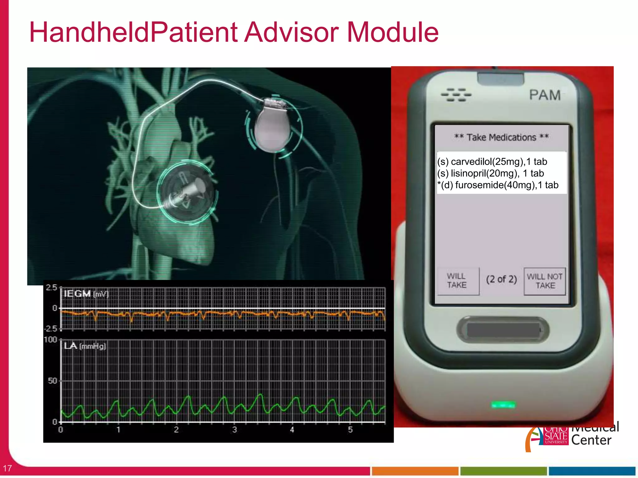 (s) carvedilol(25mg),1 tab(s) lisinopril(20mg), 1 tab*(d) furosemide(40mg),1 tabHandheldPatient Advisor ModulePAMPowers implant by RF