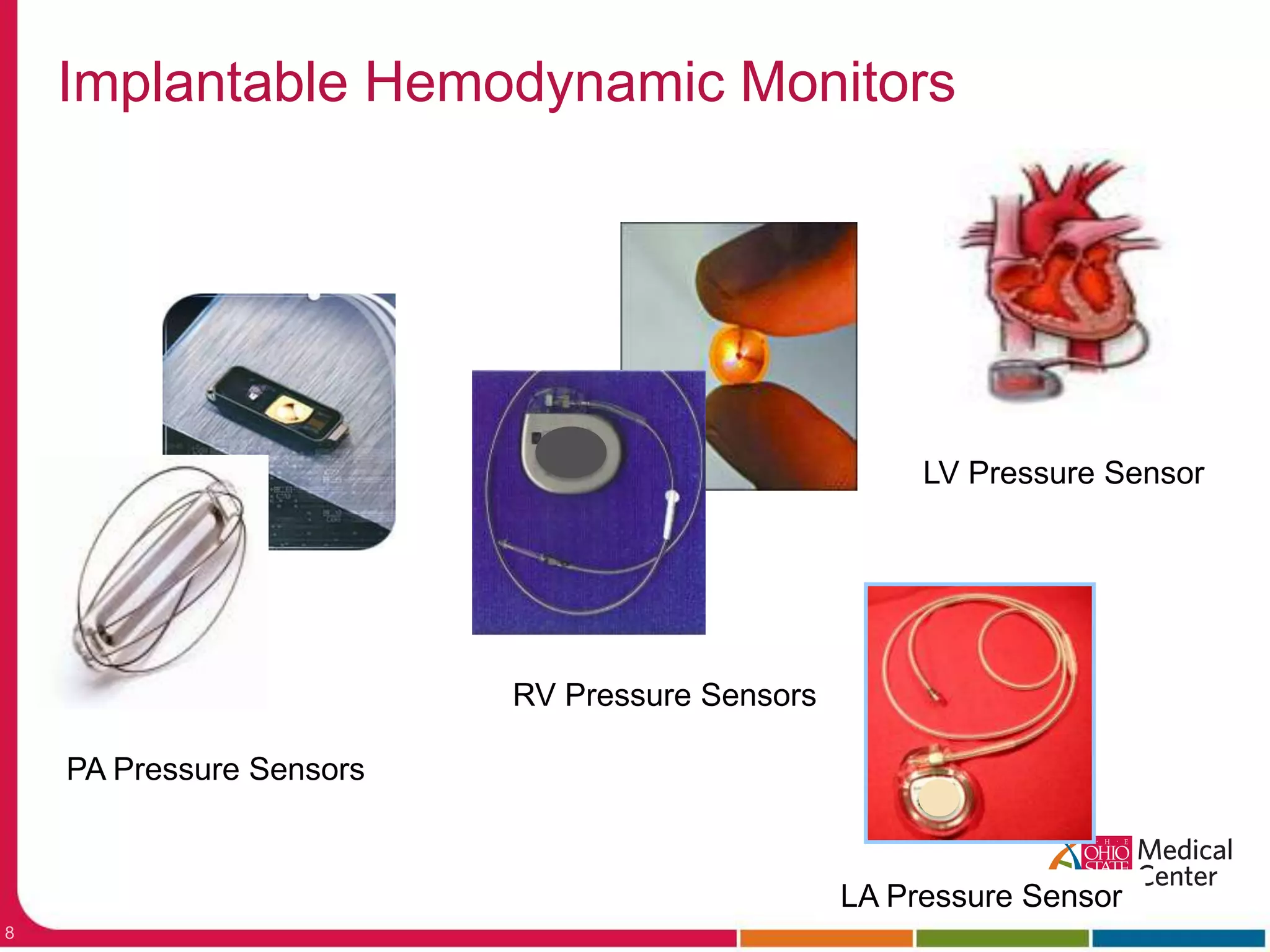LV Pressure SensorRV Pressure SensorsPA Pressure SensorsLA Pressure SensorImplantable Hemodynamic Monitors