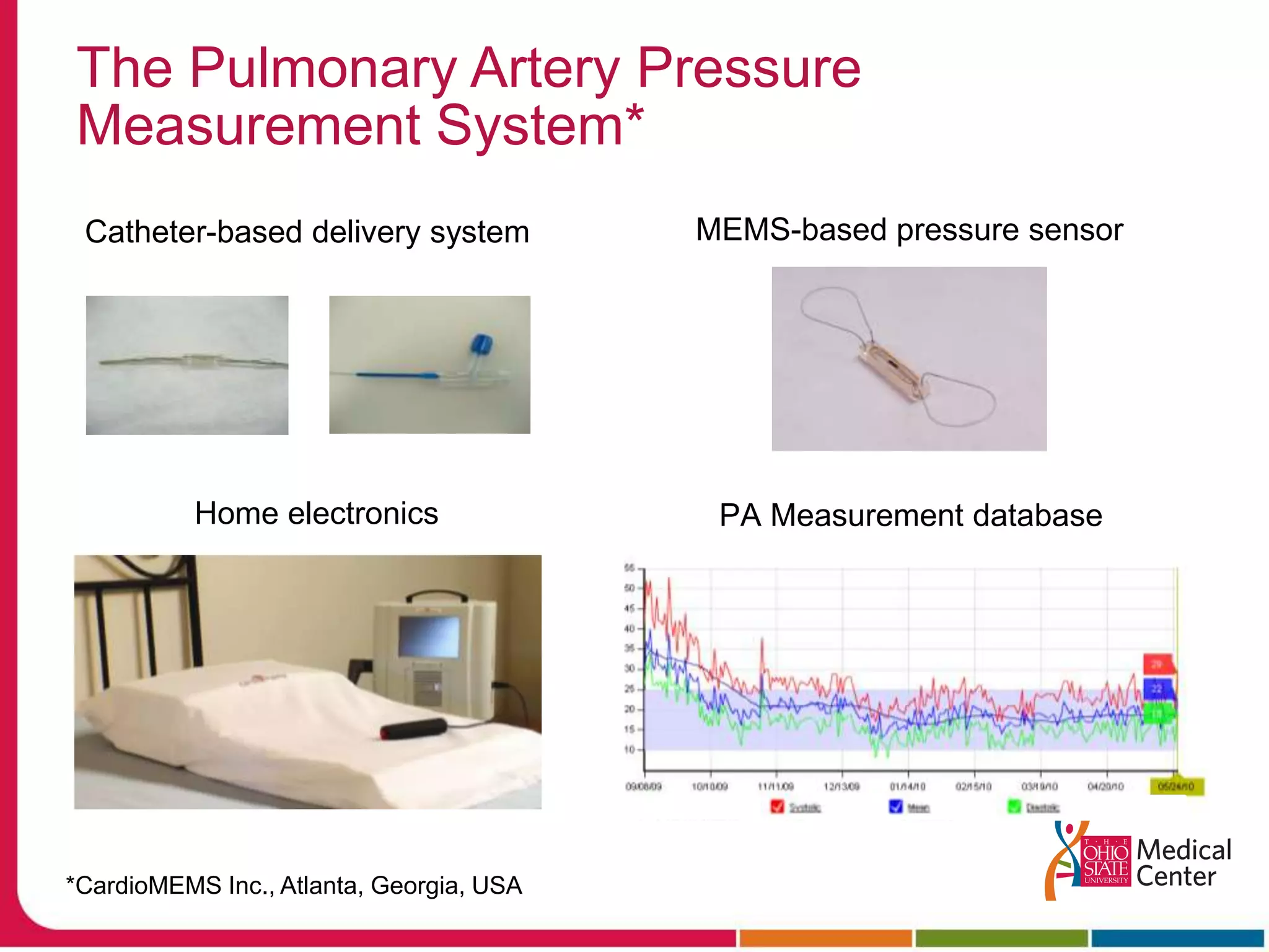 MEMS-based pressure sensorHome electronicsPA Measurement databaseThe Pulmonary Artery Pressure Measurement System*Catheter-based delivery system*CardioMEMS Inc., Atlanta, Georgia, USA