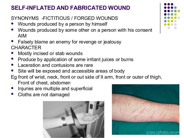 FABRICATED WOUNDS EBOOK DOWNLOAD FABRICATED WOUNDS EBOOK DOWNLOAD