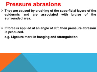 Pressure abrasions
 They are caused by crushing of the superficial layers of the
epidermis and are associated with bruise of the
surrounded area.
 If force is applied at an angle of 90º, then pressure abrasion
is produced.
e.g. Ligature mark in hanging and strangulation
 