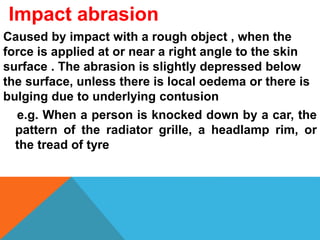 Impact abrasion
Caused by impact with a rough object , when the
force is applied at or near a right angle to the skin
surface . The abrasion is slightly depressed below
the surface, unless there is local oedema or there is
bulging due to underlying contusion
e.g. When a person is knocked down by a car, the
pattern of the radiator grille, a headlamp rim, or
the tread of tyre
 