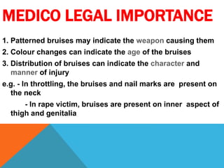 MEDICO LEGAL IMPORTANCE
1. Patterned bruises may indicate the weapon causing them
2. Colour changes can indicate the age of the bruises
3. Distribution of bruises can indicate the character and
manner of injury
e.g. - In throttling, the bruises and nail marks are present on
the neck
- In rape victim, bruises are present on inner aspect of
thigh and genitalia
 