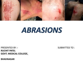 ABRASIONS
PRESENTED BY :- SUBMITTED TO :
RUCHIT PATEL
GOVT. MEDICAL COLLEGE,
BHAVNAGAR
 