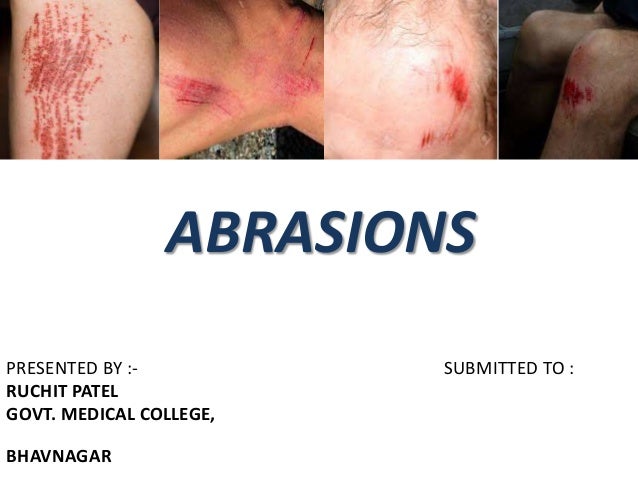 abrasions