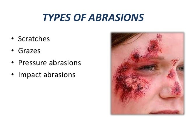 abrasions