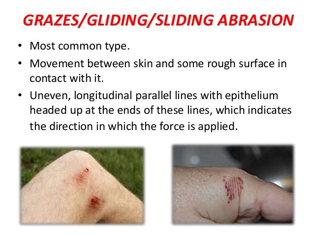 abrasions